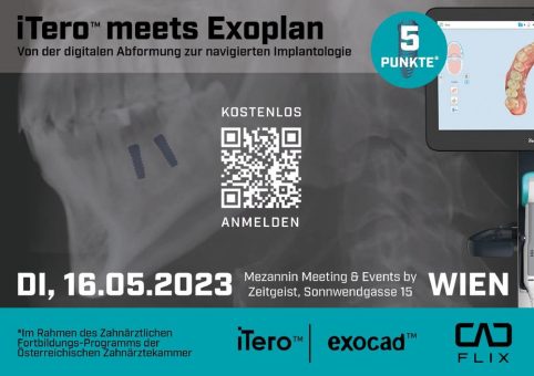 iTero™ meets Exoplan (Vortrag | Wien)