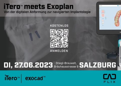 iTero™ meets Exoplan (Vortrag | Salzburg)