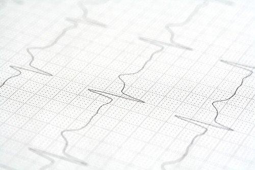 Offene Rhythmus-Sprechstunde – Patientenseminar (Seminar | Essen)